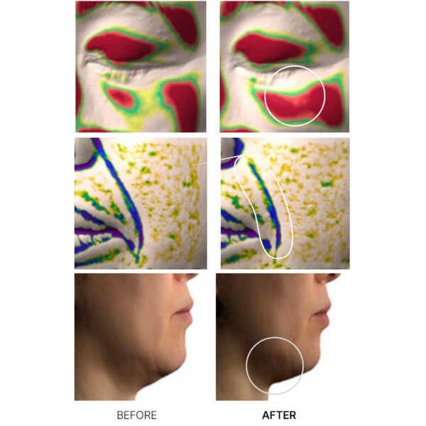 Arocell Super Collagen Booster Bubble Serum 70ml