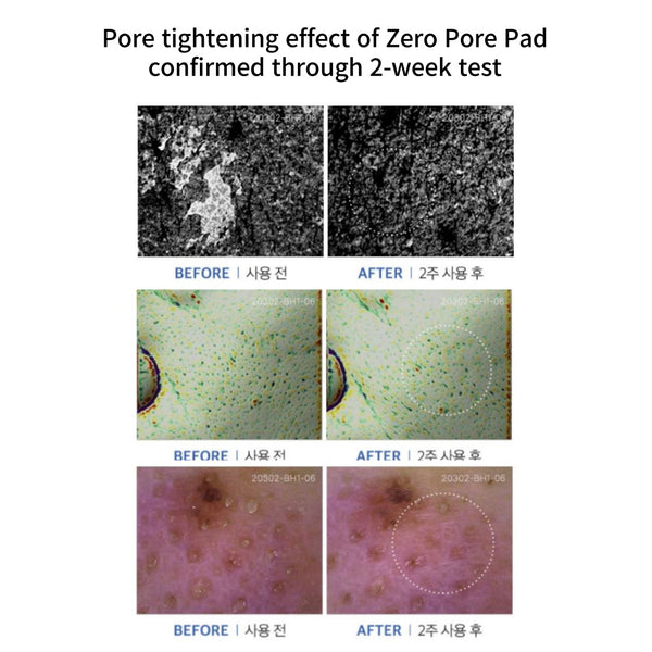 Zero Pore Pad 2.0